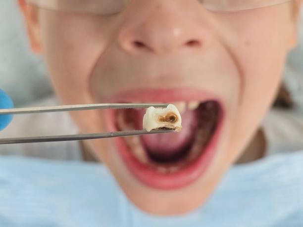Best Emergency Pediatric Dental Care in Charles City, IA